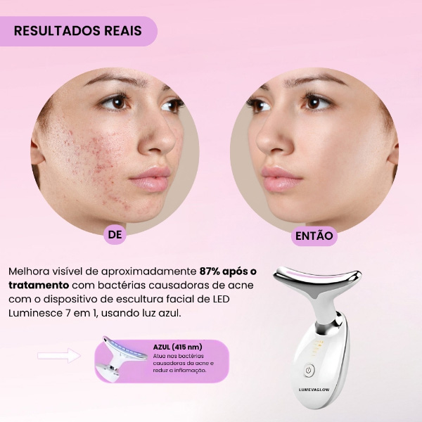 LUMEVAGLOW_18.4.2025_HANA_IMAGE_V13_1_1_PT__db547b91